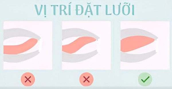 Mặt lệch - Nguyên nhân và cách cải thiện mặt lệch hiệu quả tại nhà