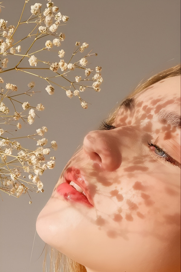 Peel da có tốt không? Cách chăm sóc da sau peel mà bạn cần biết