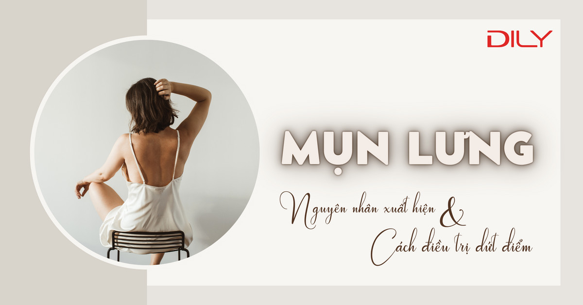 Nguyên nhân bị mụn lưng? Thói quen giúp trị dứt điểm mụn lưng